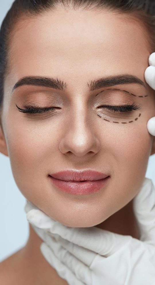 Безоперационная блефаропластика Альтера