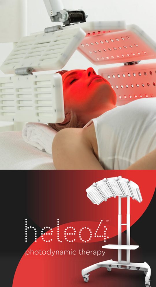 Фотодинамическая терапия Heleo-4