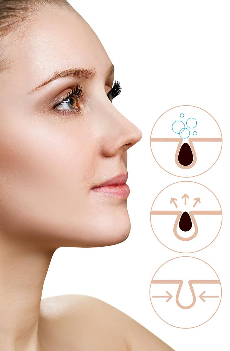 Атравматическая чистка лица и уход Danne