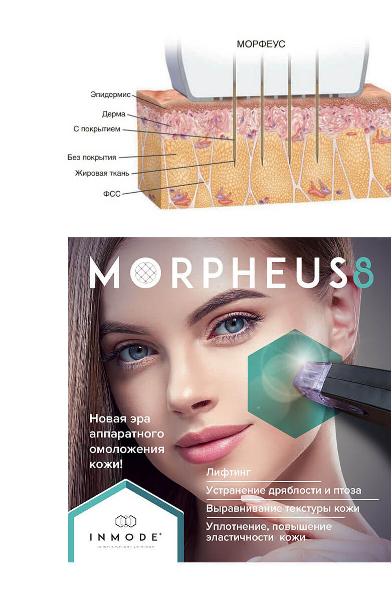 Микроигольчатый RF-лифтинг Morpheus 8