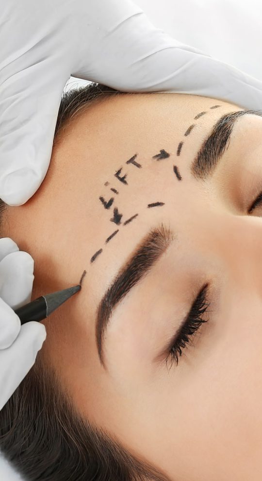 Эндоскопический лифтинг лба и бровей