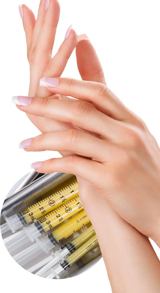 Липофилинг кистей рук