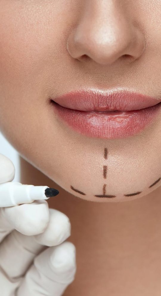 Ментопластика