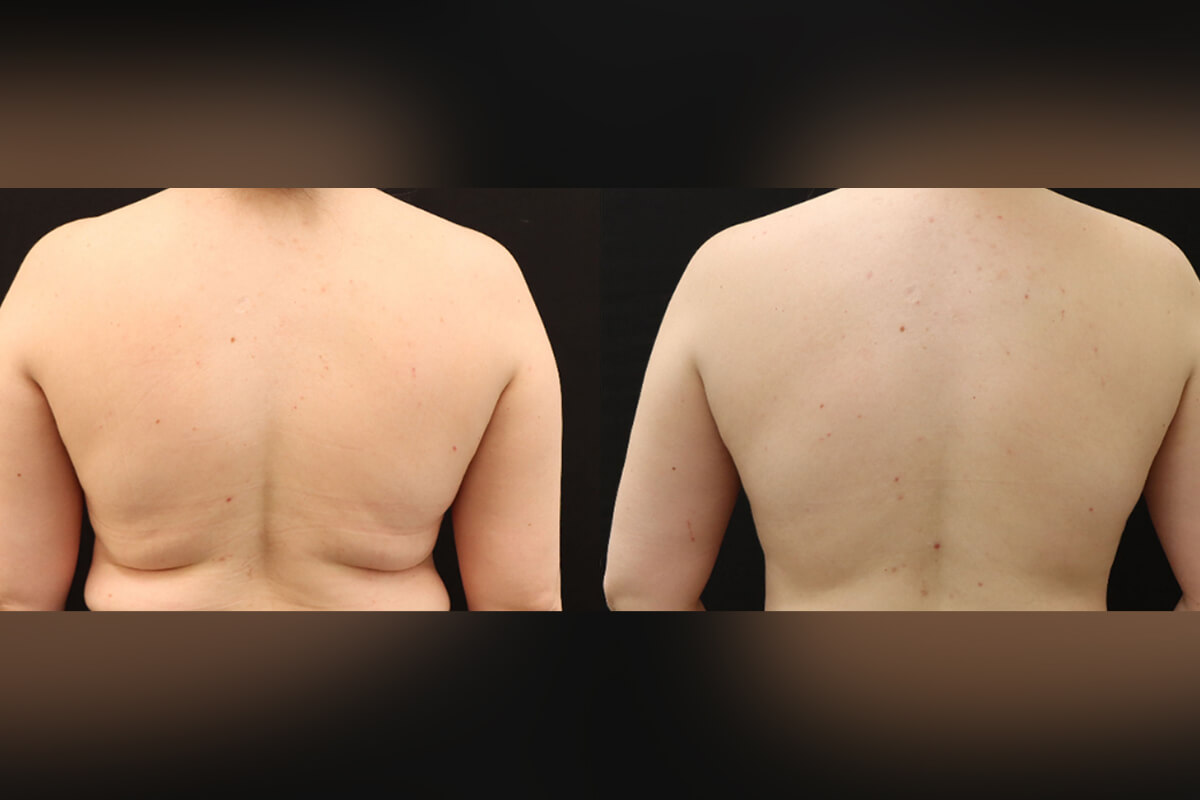 Аппарат EVOLVE 01