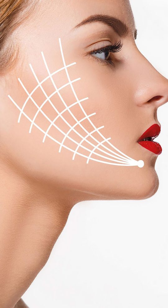 Нитевой лифтинг лица