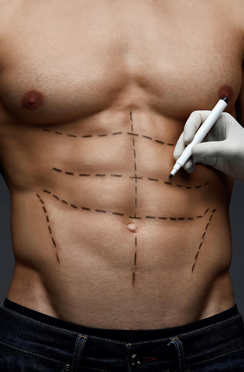 vysokotochnaya-liposaktsiya-hd-2