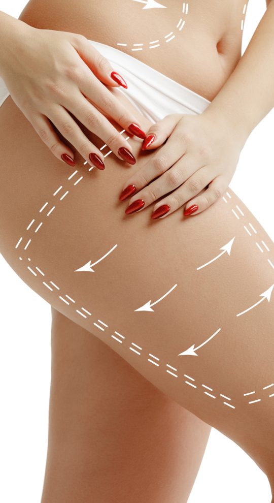 Антицеллюлитный массаж