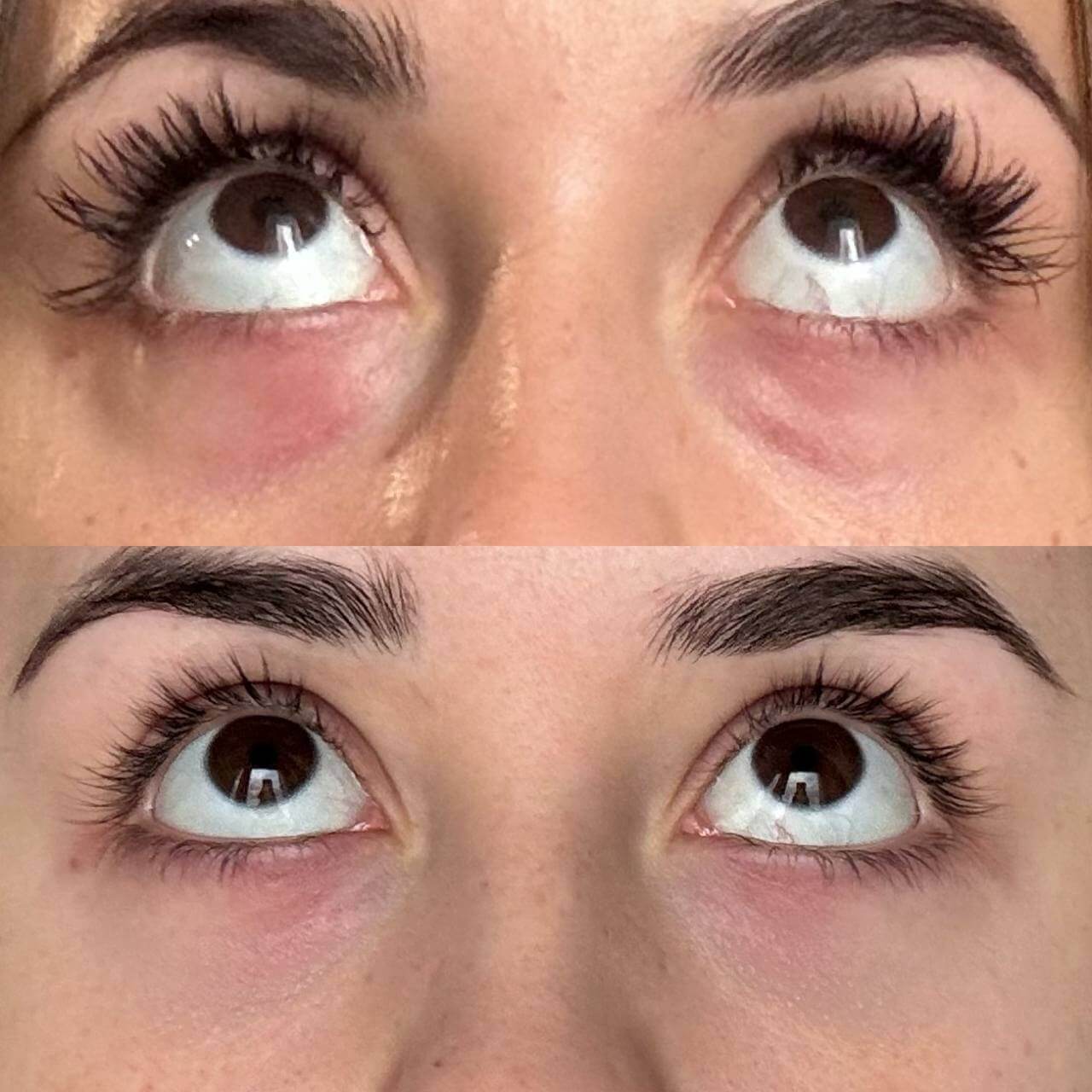 Препарат Сферогель 01