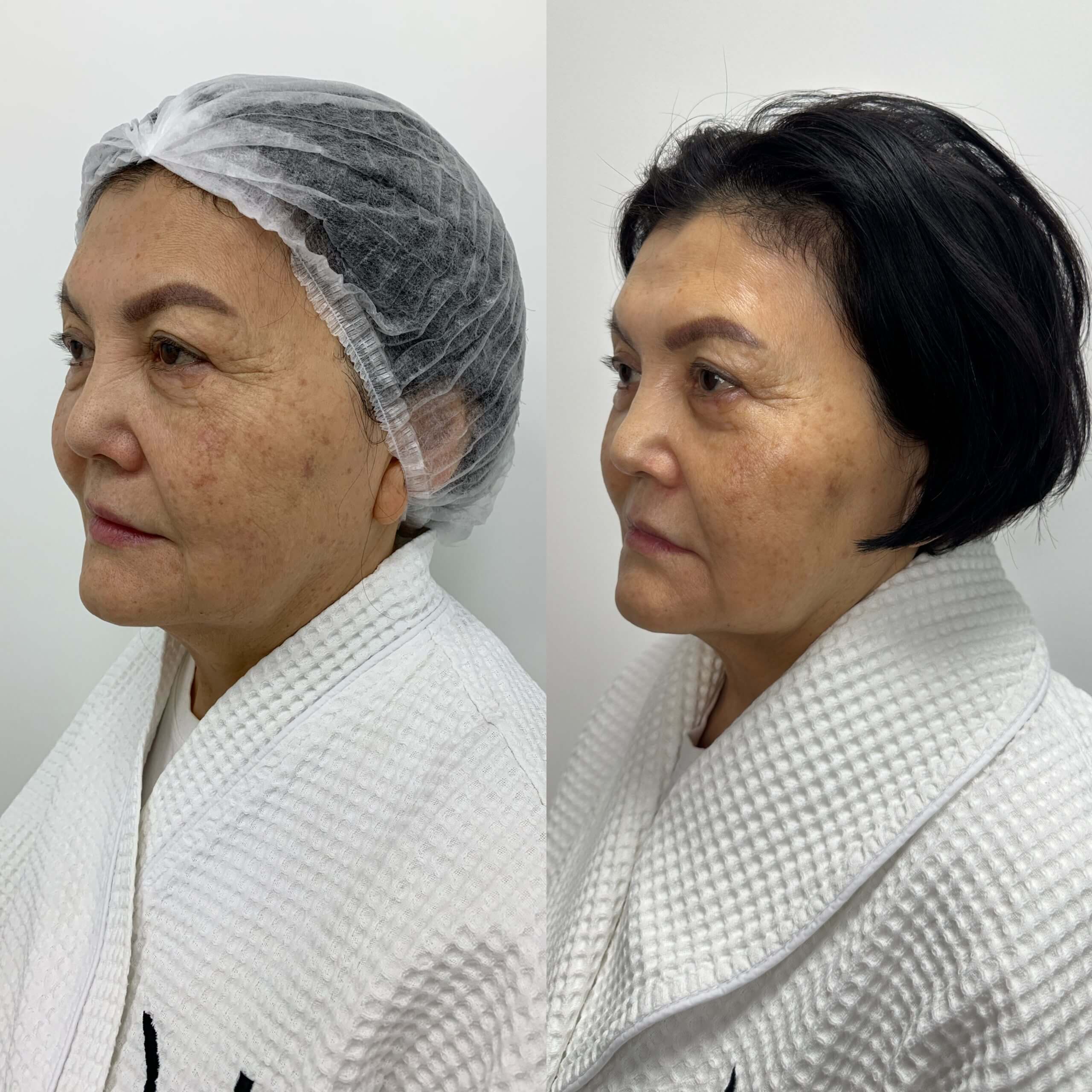 Ультраформер MPT 01