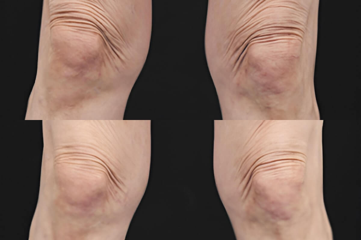 Ультраформер MPT 01