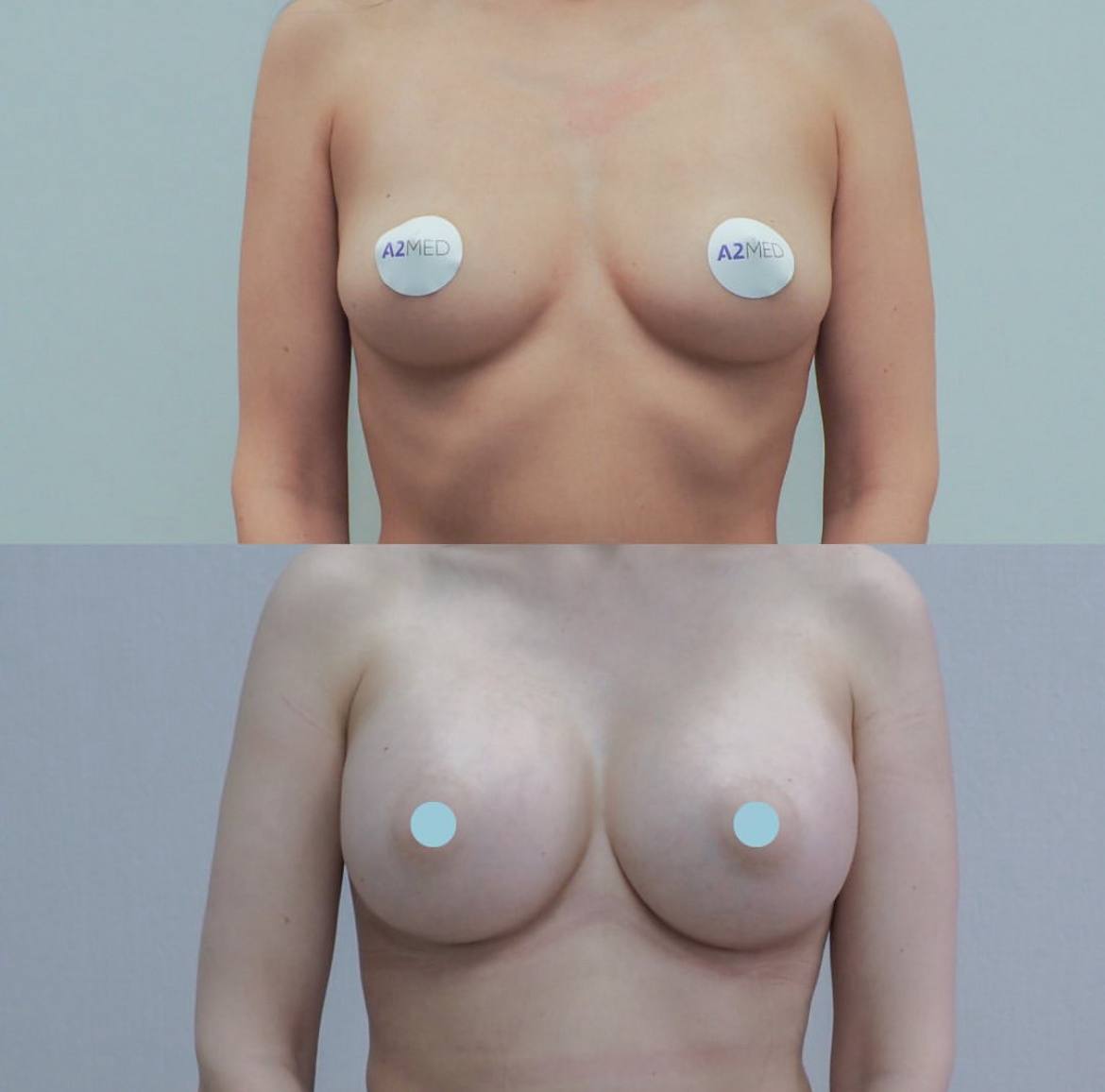 Грудь для мам 01