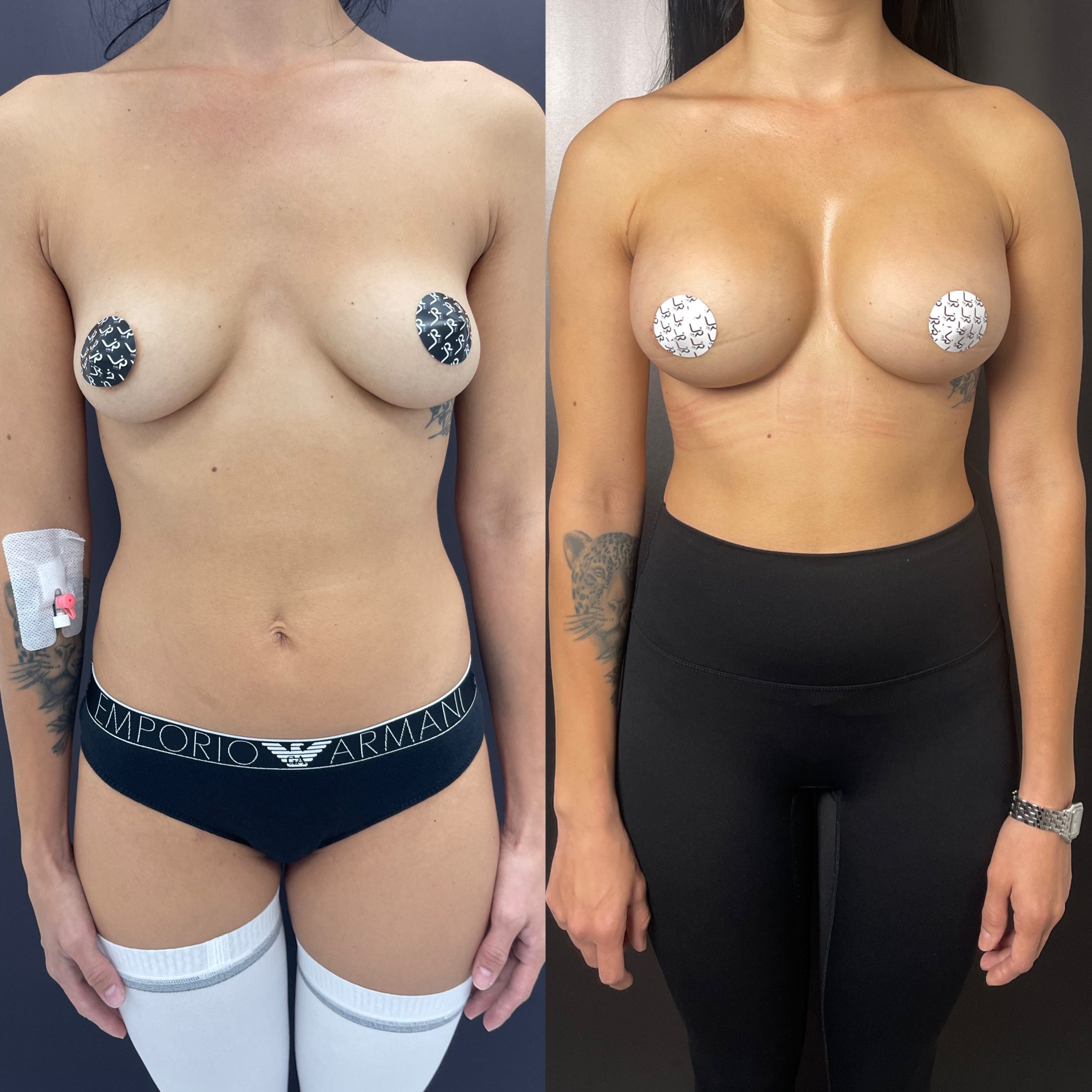 Грудь для мам 01