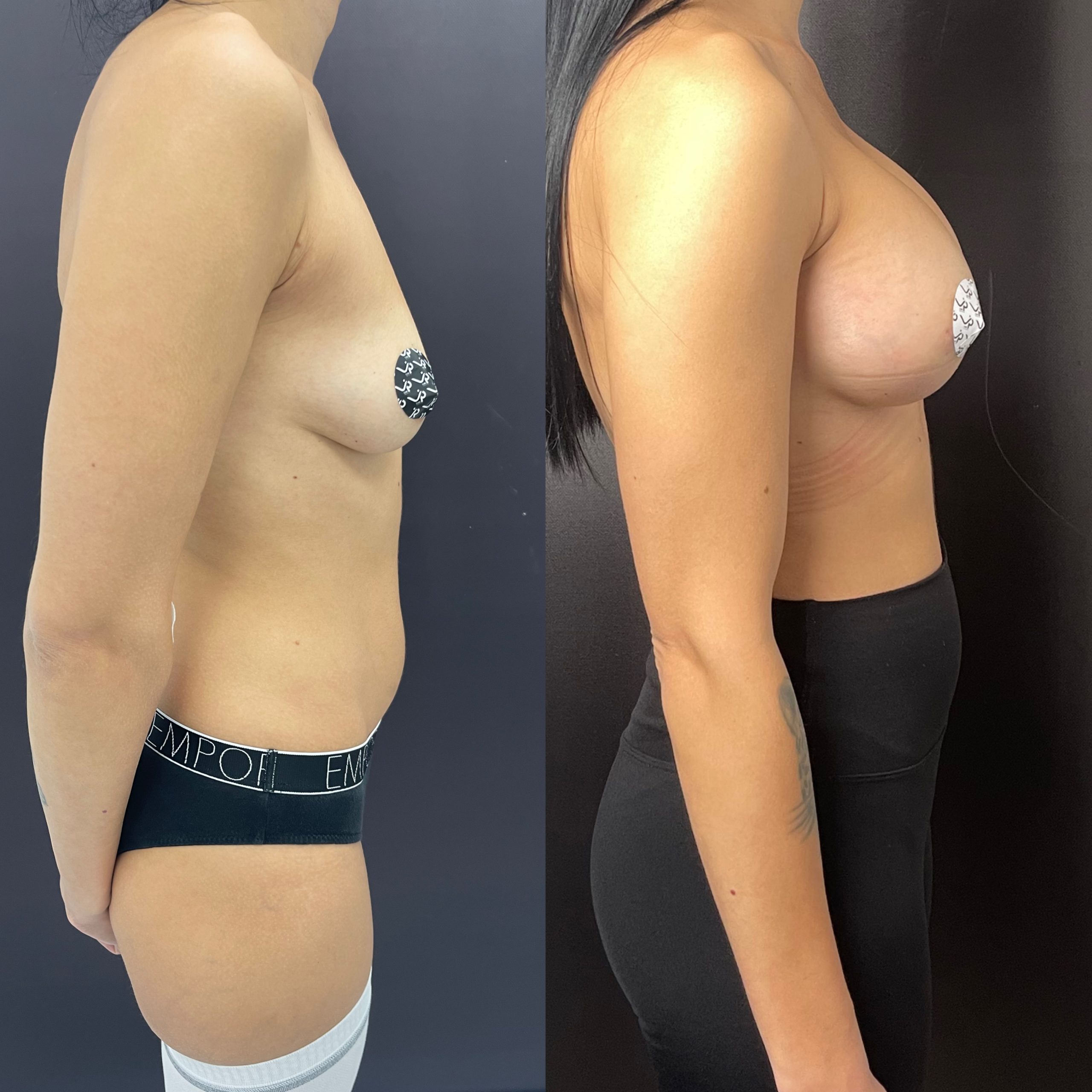 Грудь для мам 01