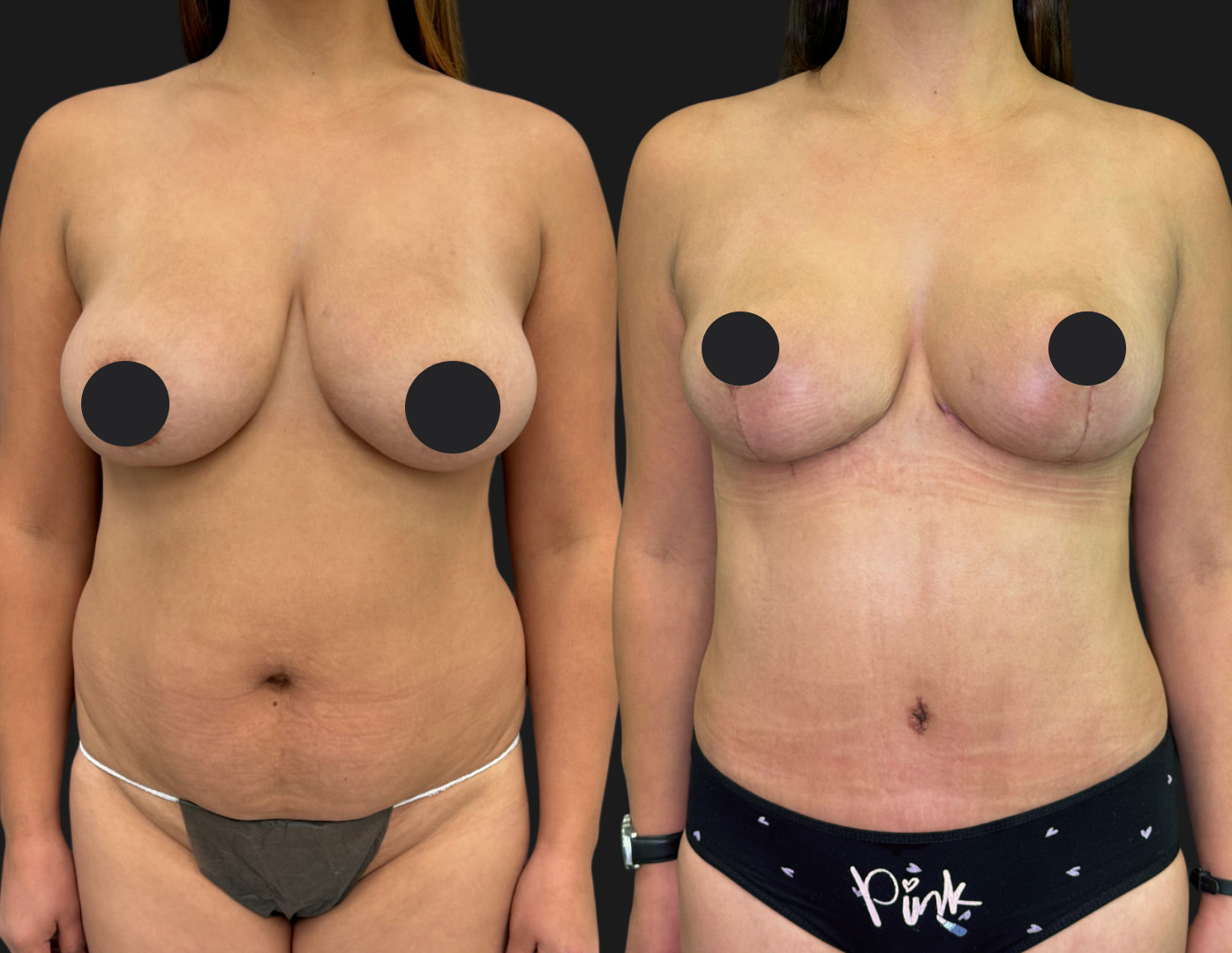 Грудь для мам 01