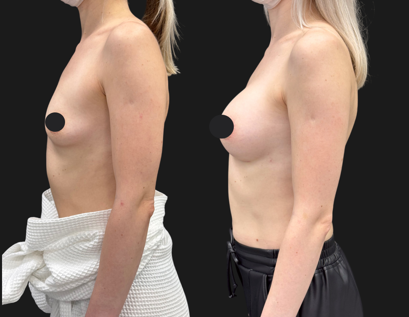 Грудь для мам 01