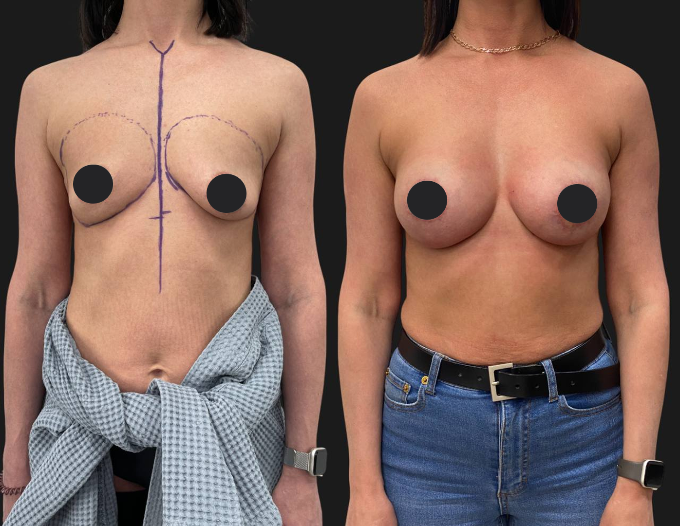 Грудь для мам 01