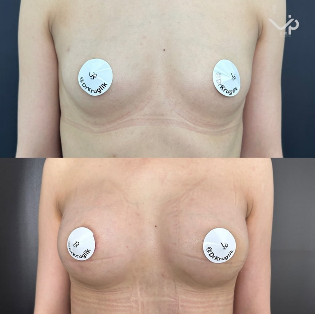 Грудь для мам 01