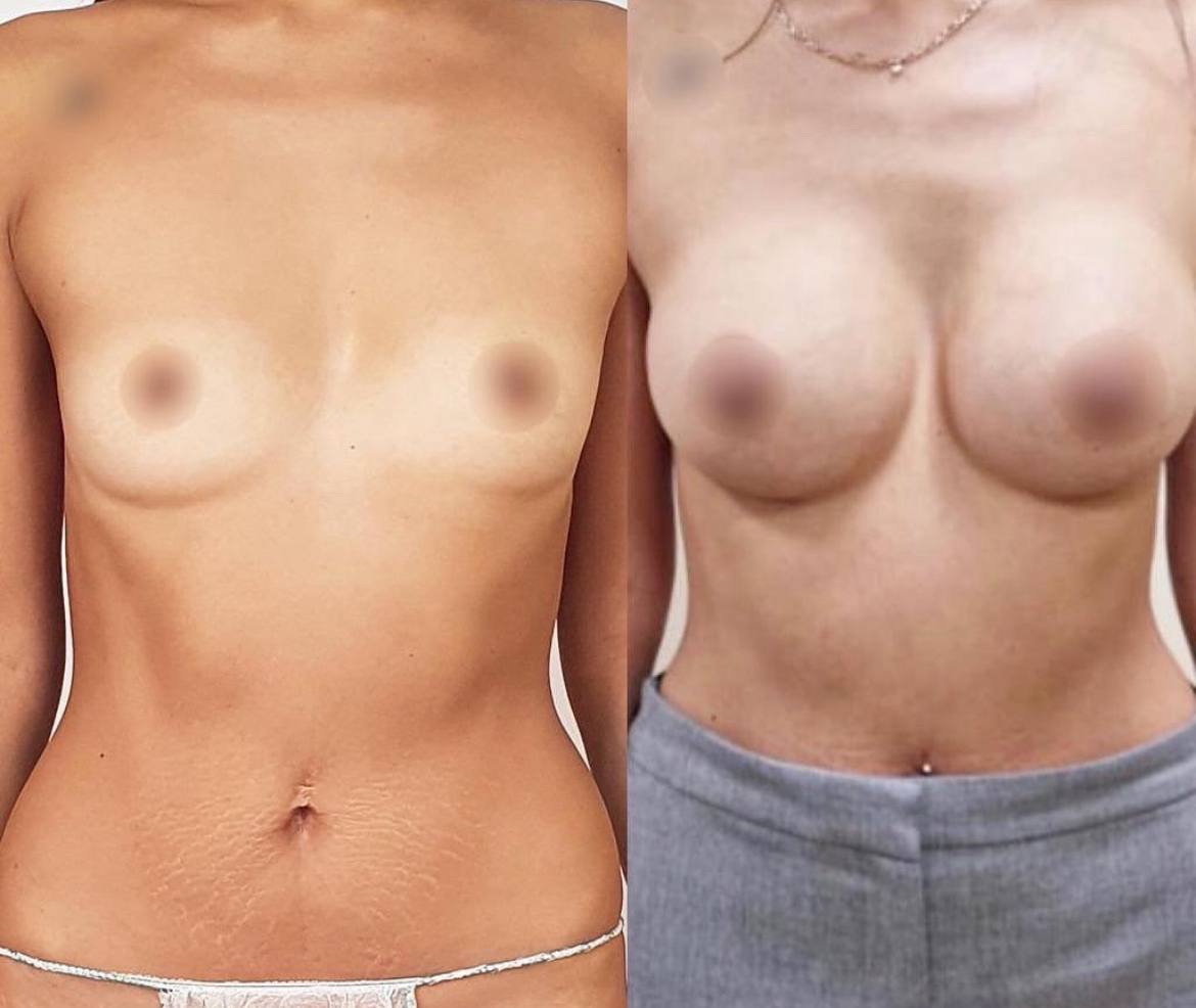 Грудь для мам 01