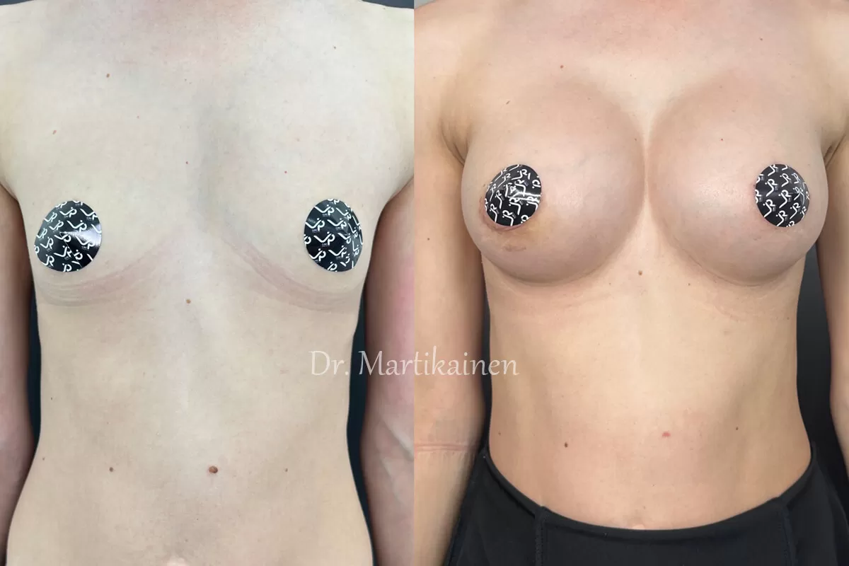 Грудь для мам 01